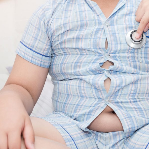 Otyłość u dzieci – przyczyny, leczenie, skutki